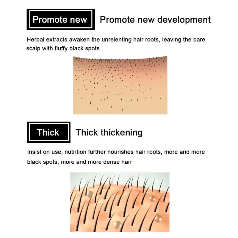 Wisessence™ Ginger Hair care essential oil