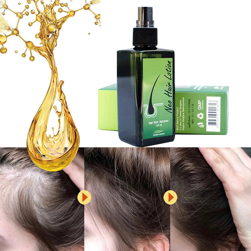 Wisessence™ Neo Hair lotion essential oil