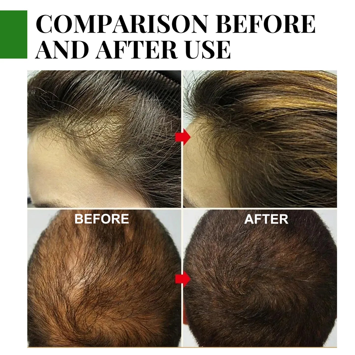 Wisessence™ Olio essenziale per la cura dei capelli al rosmarino 